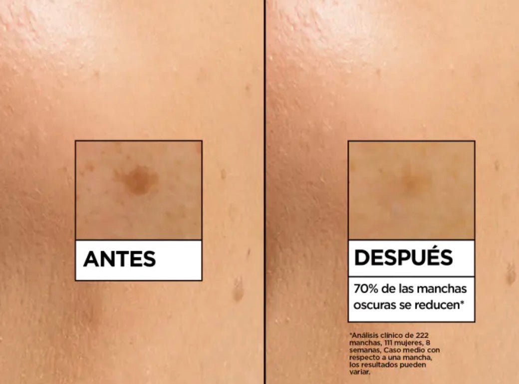 Sérum anti-taches garnier